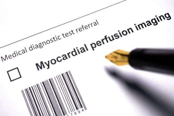 myocardial perfusion imaging