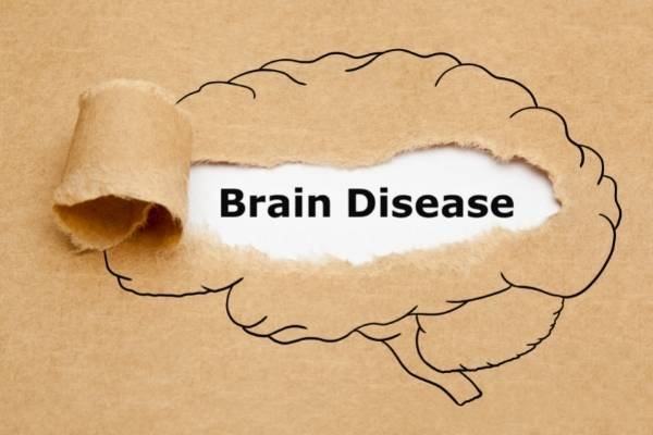 brain disease treatment