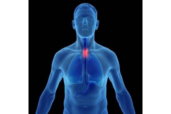 esophageal cancer detection